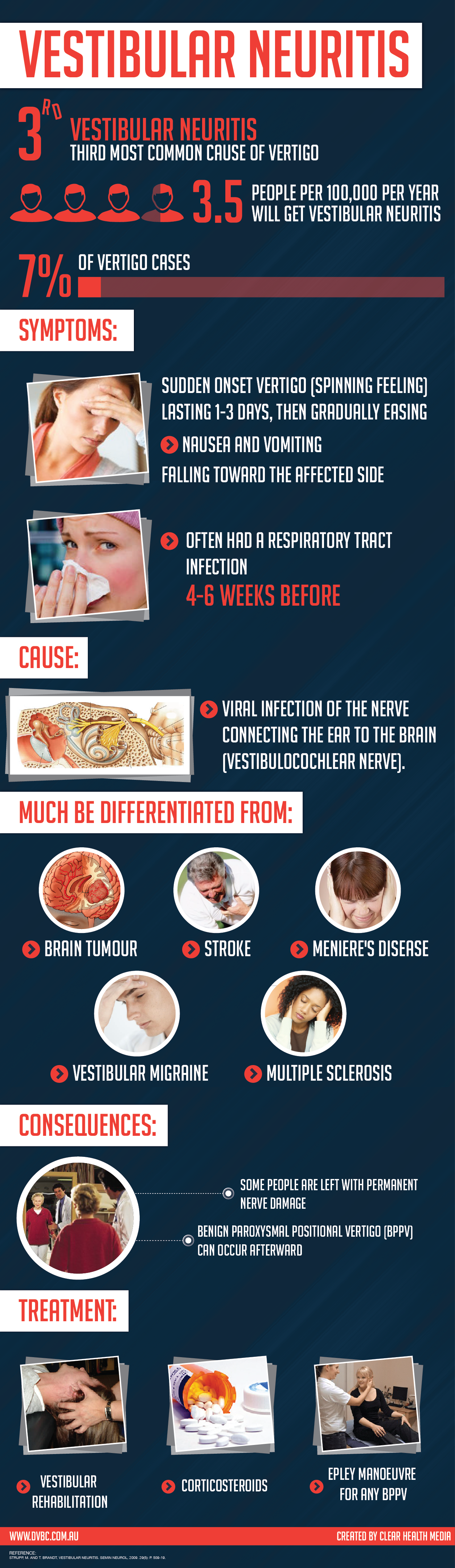 What Is Vestibular Neuritis Patient Talk